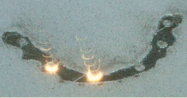 Selective laser melting of dental implant bridge